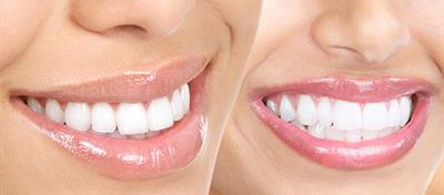 Comprehensive Dental Check Up
Meola Dental